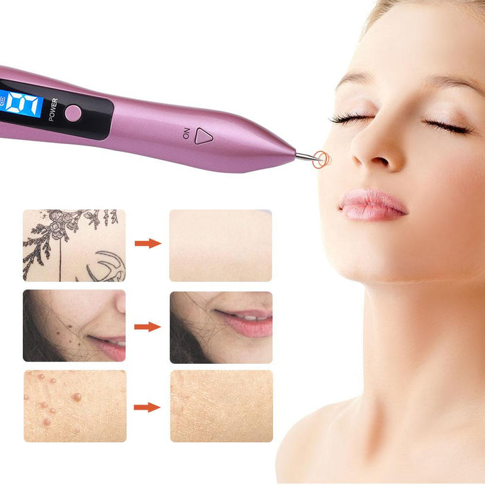 Skin Tag Removal Mole Plasma Pen